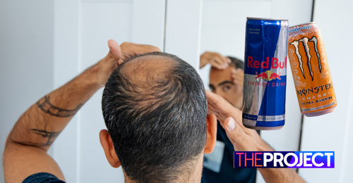 Study Finds Drinking Energy Drinks Causes Hair Loss In Men - Network Ten