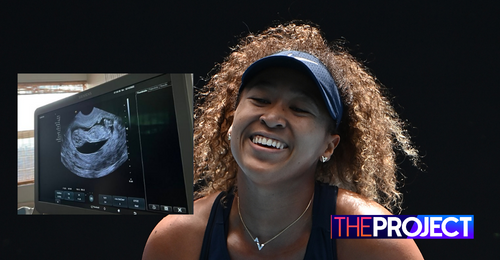 Naomi Osaka Announces She's Pregnant with Her First Child