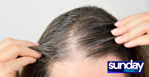 Home Remedies For Grey Hair How To Stop Premature Greying Of Hair And  Prevent Naturally