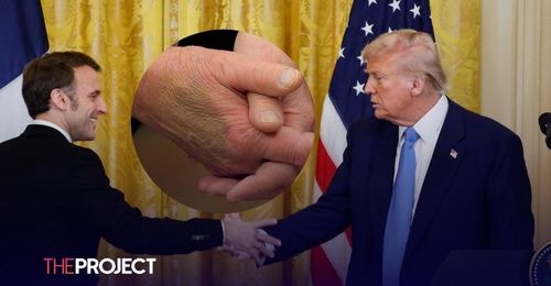 President Trump Is Spotted With A Large Bruise on His Hand