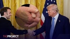 President Trump Is Spotted With A Large Bruise on His Hand