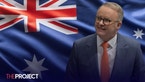 Reports Show That Support For Anthony Albanese Has Risen Ahead Of Federal Election